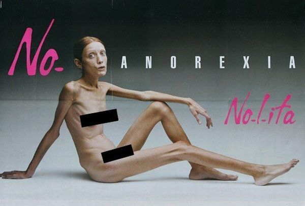 Топ-5 моделей з анорексією, смерть яких потрясла світ