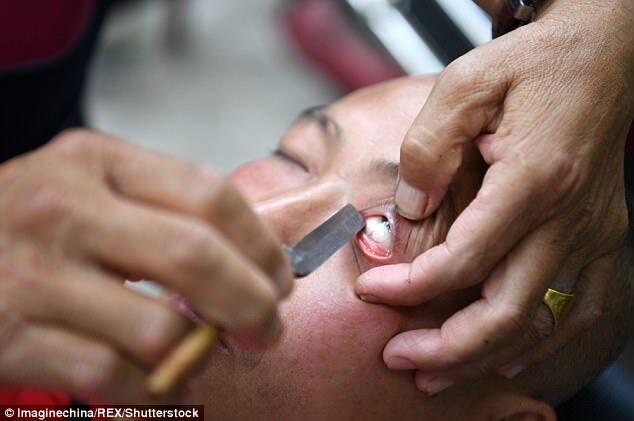 Поголили очі: в мережі показали унікальний метод "лікування" в Китаї