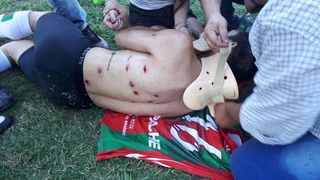 Полиция в Аргентине расстреляла футболистов во время матча: жуткие фото раненых