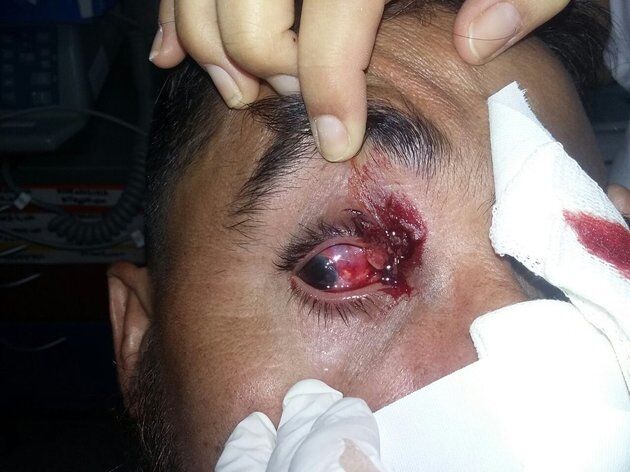 Полиция в Аргентине расстреляла футболистов во время матча: жуткие фото раненых