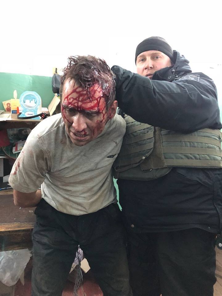 Захват заложников в Харькове на “Укрпочте”: опубликовано окровавленное фото преступника