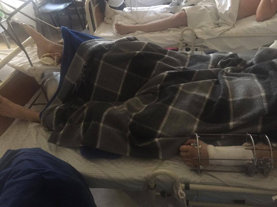У київському госпіталі потрібна допомога для тяжкопоранених бійців АТО