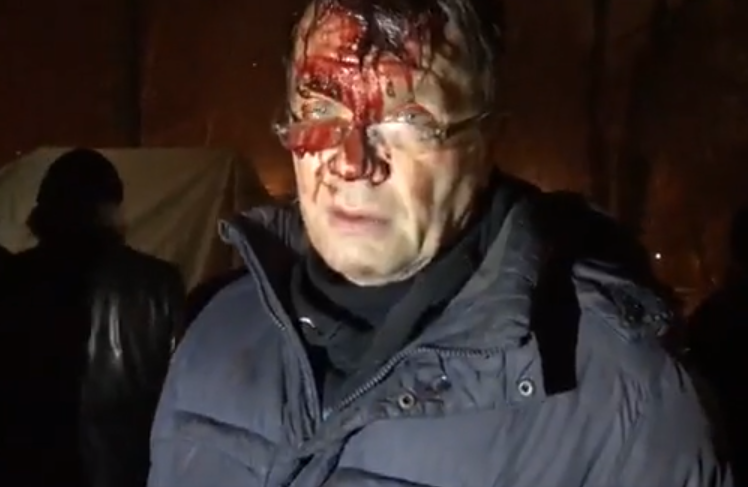 В Киеве сторонники Саакашвили подрались с полицией: есть пострадавшие