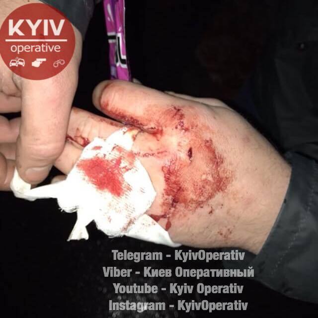 "Сам все порешаю": в Киеве произошел кровавый конфликт с пьяным "героем"