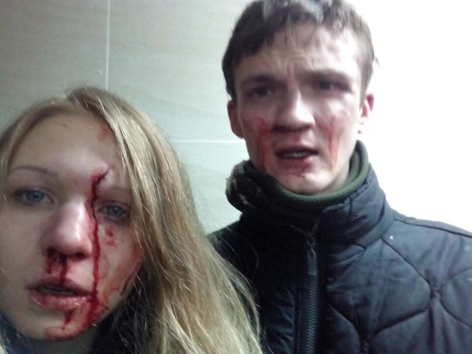 "Ті ж, хто вніс заставу": у Києві побили Віту Заверуху та її хлопця