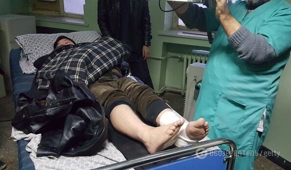 В Кабуле смертник взорвал десятки людей: жуткий фоторепортаж