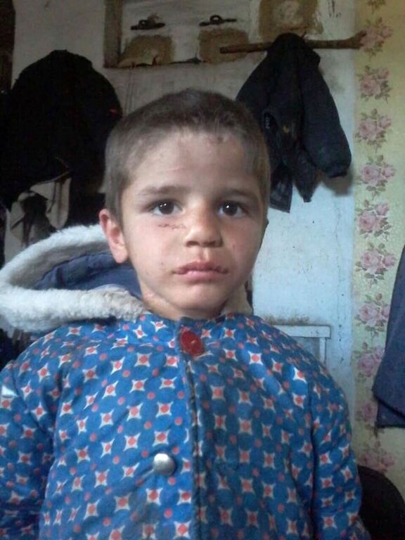 "Сашка взимку зачинили на літній кухні, а ми його викрали". Як живе один із найскандальніших героїв "Говорить Україна", якому мама вибила зуби