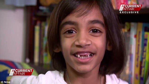 ''Хочу избавиться от них'': 5-летней девочке ампутируют гигантские ноги