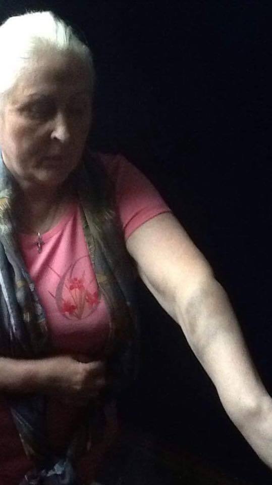 Одіозна сепаратистка Штепа показала фото, як її побили в СІЗО