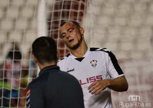 Футболисту сборной Украины разбили голову в дебютном матче за новый клуб: появились фото инцидента