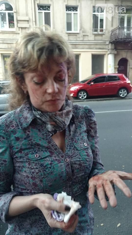 Голова розбита до крові: в Одесі напали на проукраїнську активістку
