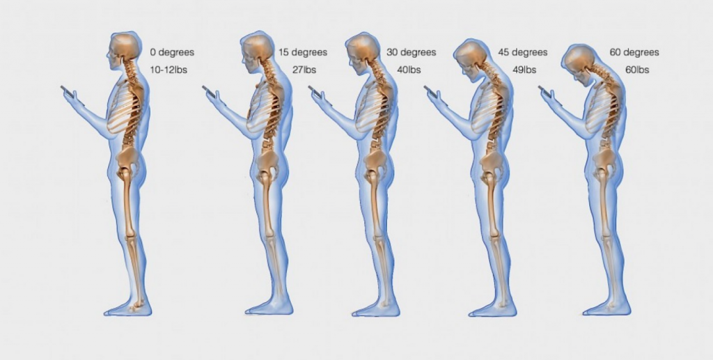 Лікарі розповіли, як смартфон впливає на шию і спину