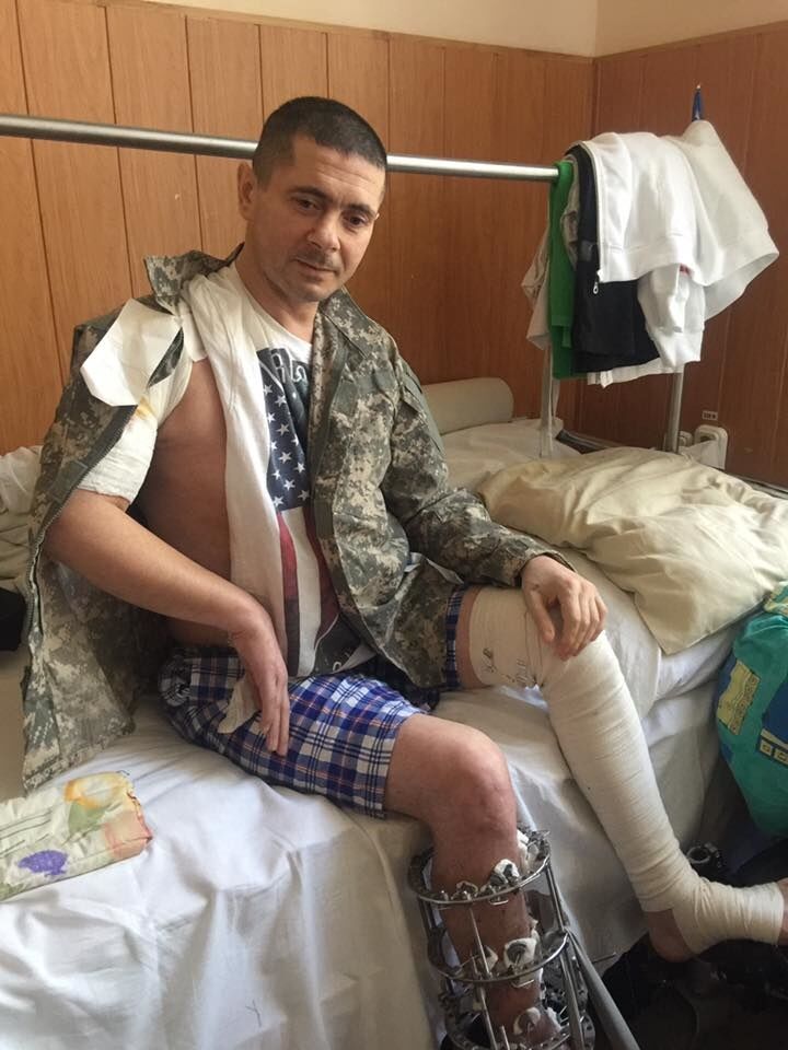 Требуется помощь! В Киев доставили тяжелораненых бойцов АТО
