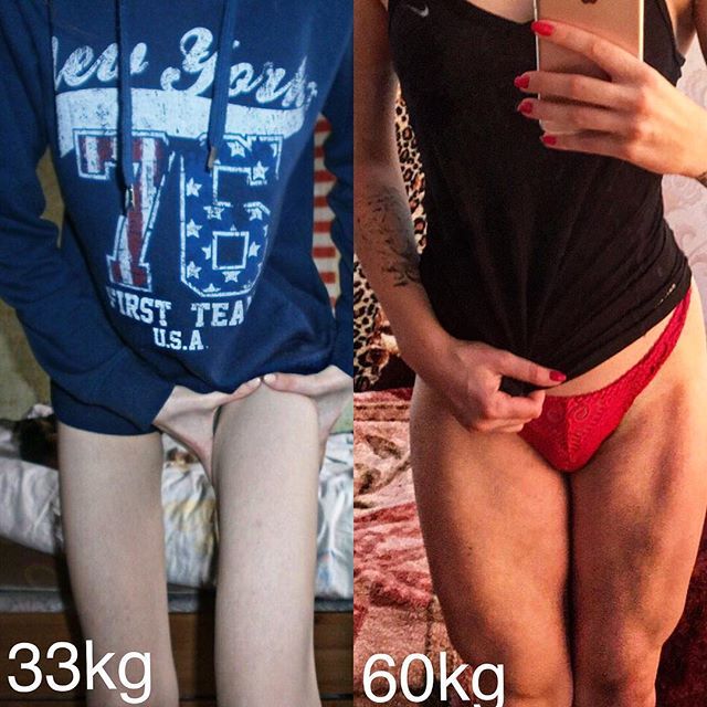 Больная анорексией девушка после невероятной трансформации стала фитнес-тренером: фотофакт