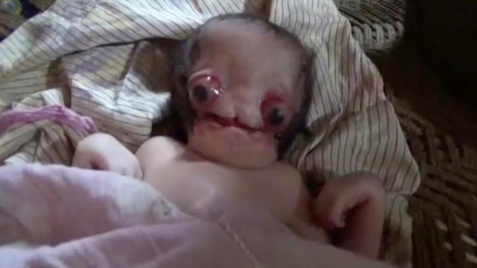 Мир поразила трагическая история младенца, прозванного ''Чужим''