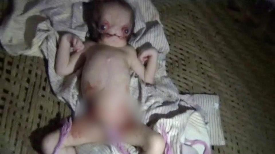 Світ вразила трагічна історія немовляти, якого прозвали ''Чужим''