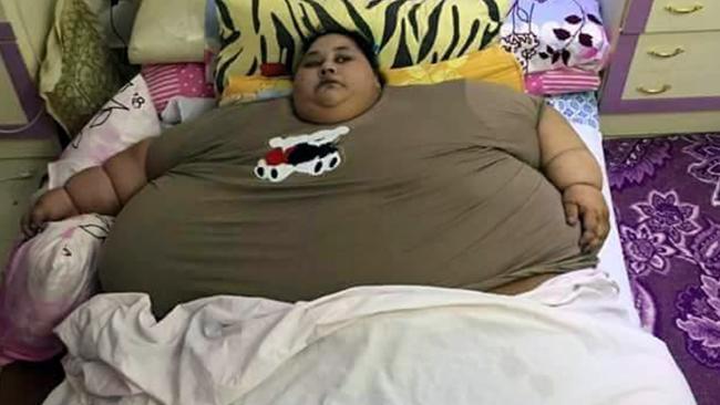 В ОАЭ умерла 300-килограммовая египтянка: фото некогда самой толстой женщины в мире