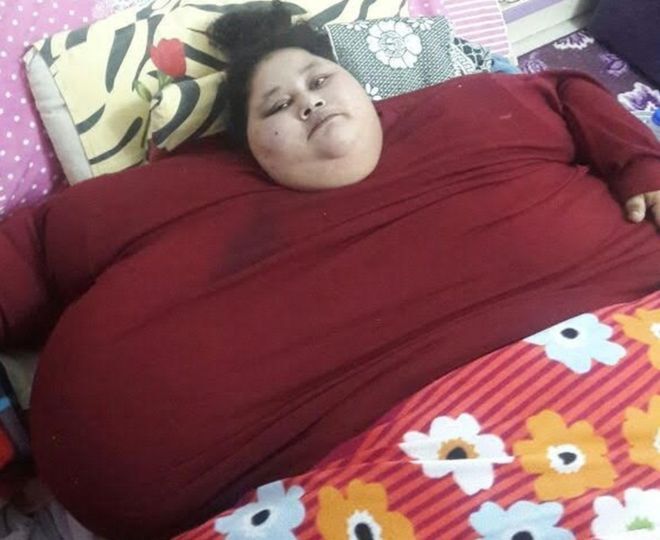 В ОАЕ померла 300-кілограмова єгиптянка: фото колись найтовщої жінки в світі