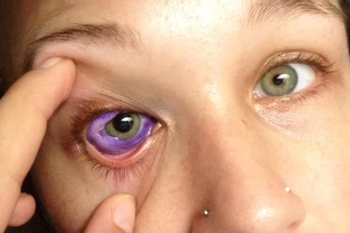 Текли фіолетові сльози: невдале татуювання знівечило око моделі