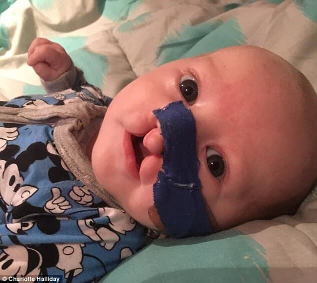 ''Впервые пускает пузыри'': родители малыша с патологией делятся его фото