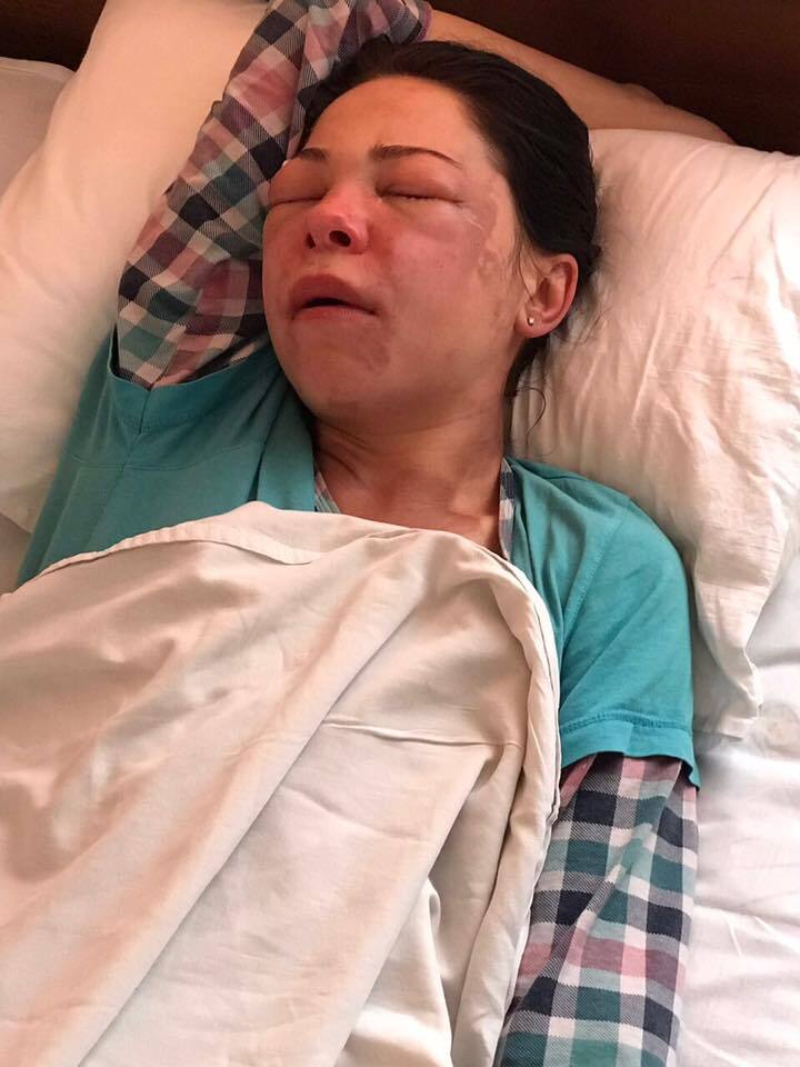 "Зрение повреждено": появились фото женщины, облитой кислотой экс-мужем в Днепре