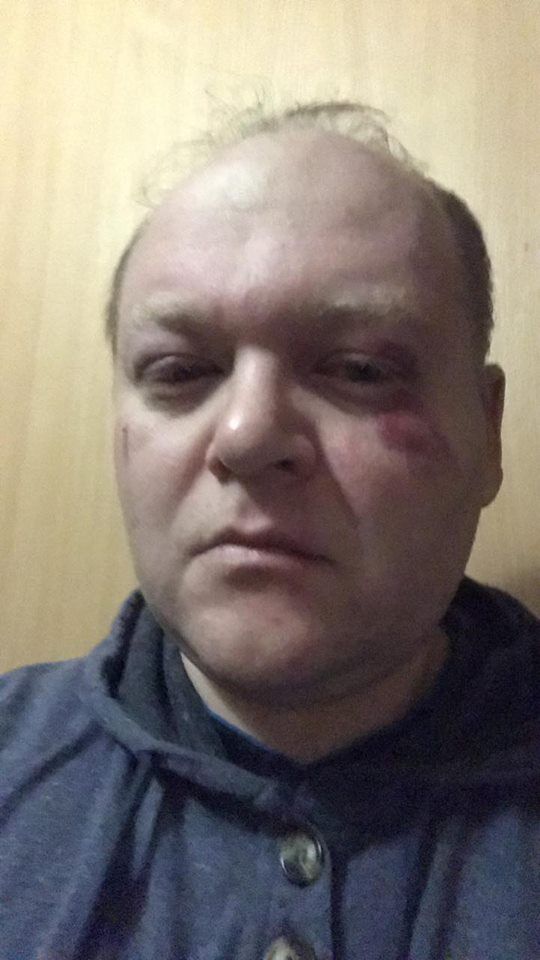 С криками "Смерть п*дарам": в Киеве избили актеров "Травести шоу"