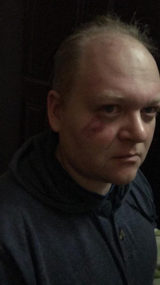С криками "Смерть п*дарам": в Киеве избили актеров "Травести шоу"