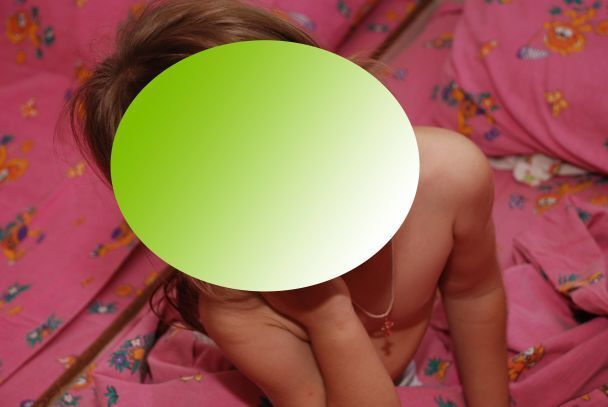 "У відкритій позі": у дитсадку Запоріжжя розгорівся скандал через фото оголених дітей
