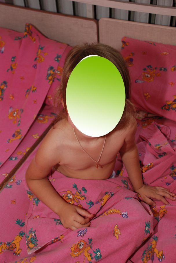"В открытой позе": в детском саду Запорожья разгорелся скандал из-за фото обнаженных детей