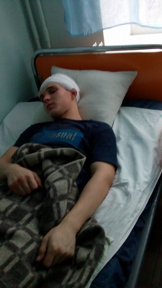"Рвать жилы руками": на Киевщине подростки зверски избили сына чиновницы