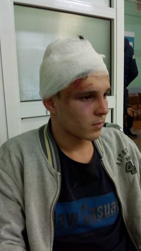 "Рвати жили руками": на Київщині підлітки по-звірячому побили сина чиновниці