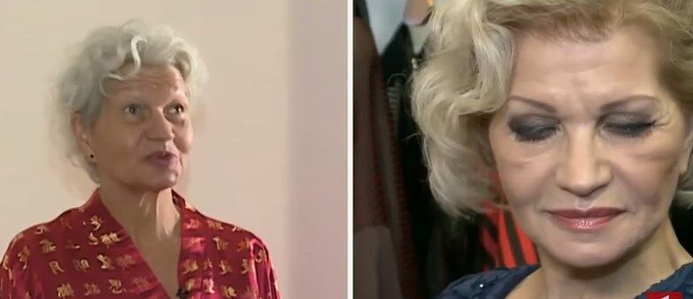 Скандальный шоумен впервые показал 63-летнюю жену после пластики: фото до и после