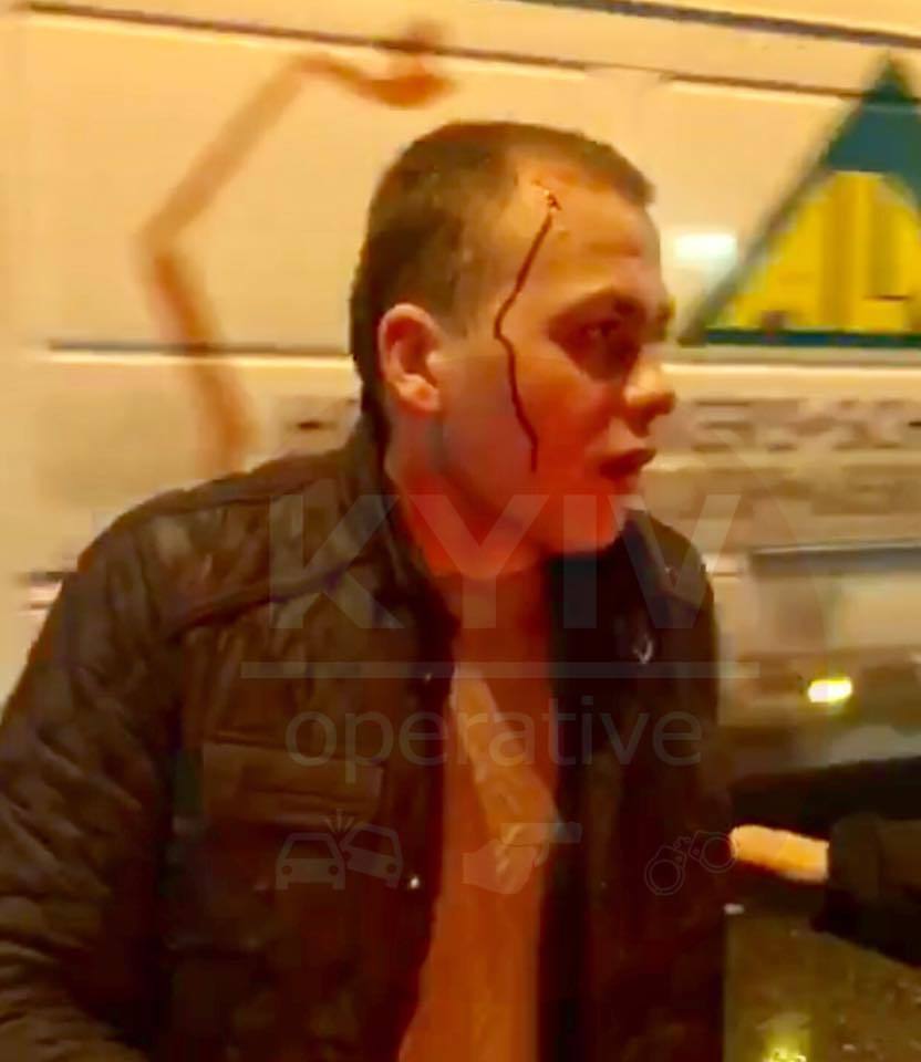 ''Я із прокуратури!'' У Києві п'яний водій влаштував масштабну аварію. Фото і відео