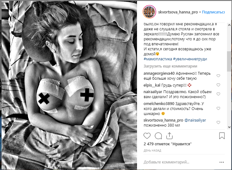 Чемпионка из Украины показала новую грудь и покорила Instagram