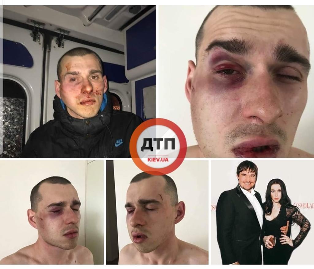 ''Били і погрожували розправою'': у Києві екстрасенс втрапила у скандал