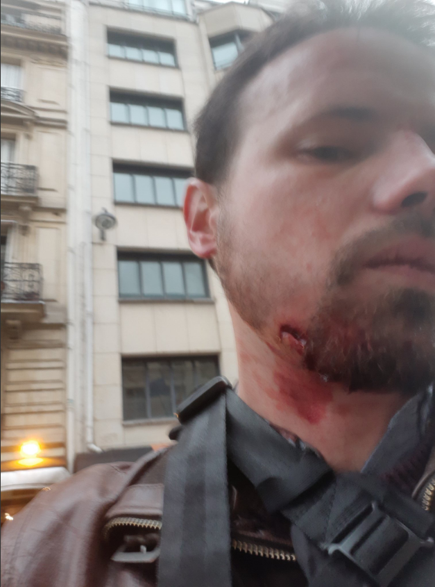 Паливний ''Майдан'' у Франції: в Парижі поранили пропагандистів Кремля, сотні затриманих 