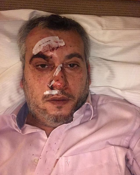 ''Так сделают во всем мире'': российского пропагандиста вышвырнули из больницы в Германии 