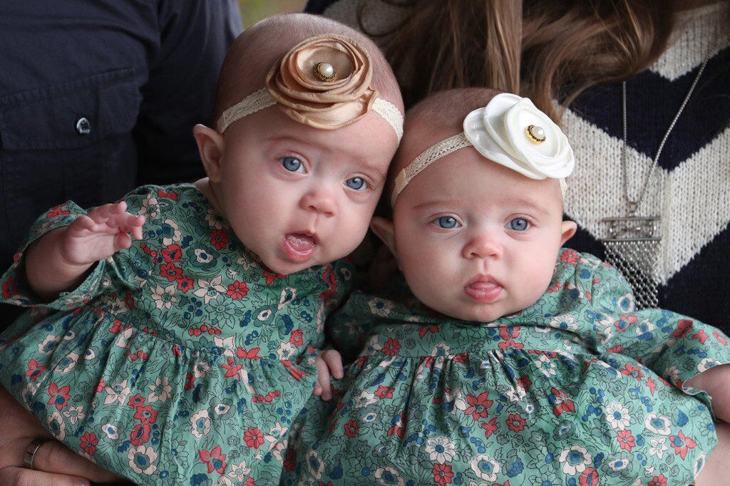 В США родились шестеро уникальных близнецов