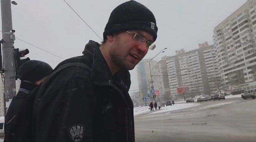 23-летнему Алексею водитель разбил нос