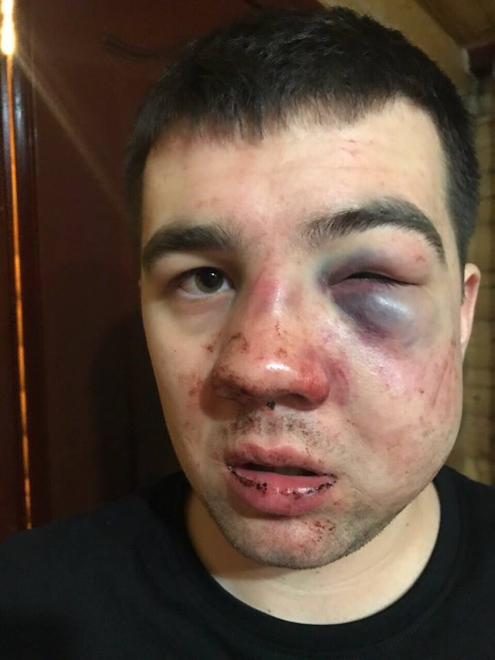 "Лихие 90-е": в "Буковеле" жестоко избили сына депутата