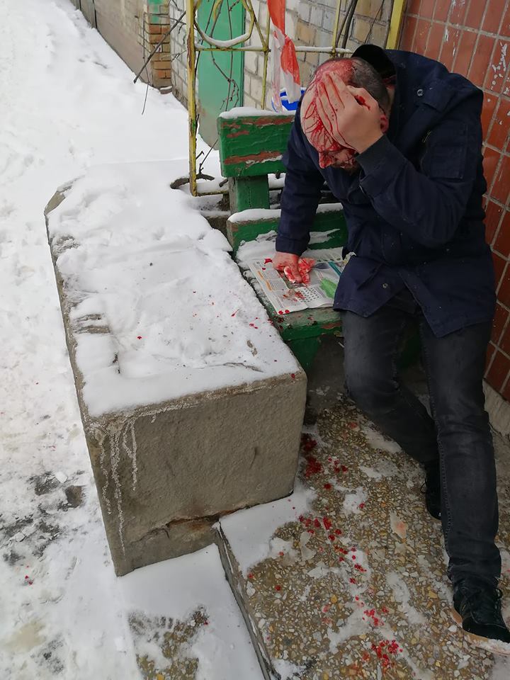 Под носом у полицейских: в Киеве разбили голову мужчине