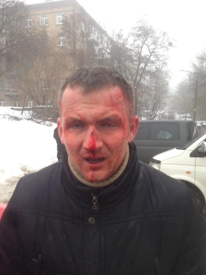 Избиение нардепа Левченко: озвучена версия полиции