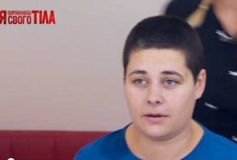 "Я соромлюсь свого тіла": украинка шокировала своей опухолью