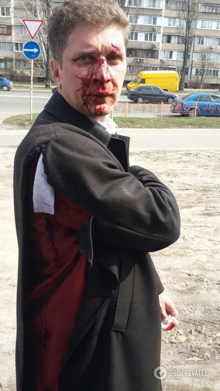 Нападение на Юрия Лиску в Киеве 6 апреля 2018 года