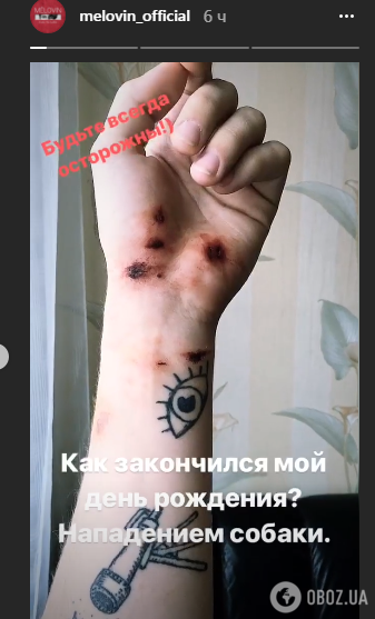 Скріншот InstaStories MELOVIN'а