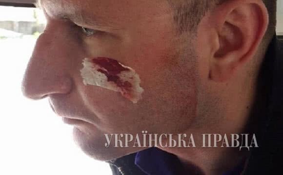На Тернопільщині сильно побили журналістів під час зйомки