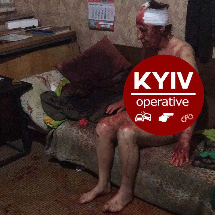 В Киеве нашли жестоко избитую окровавленную женщину: фото 18+