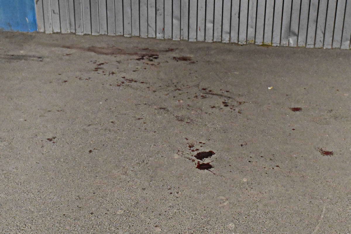Напали без розмов: у Києві жорстоко побили продюсера телеканалу