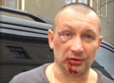 Патріота України в Криму жорстоко побив "нічний вовк". Опубліковані фото