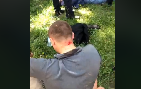  В Одессе выстрелили в затылок известному активисту: все подробности
